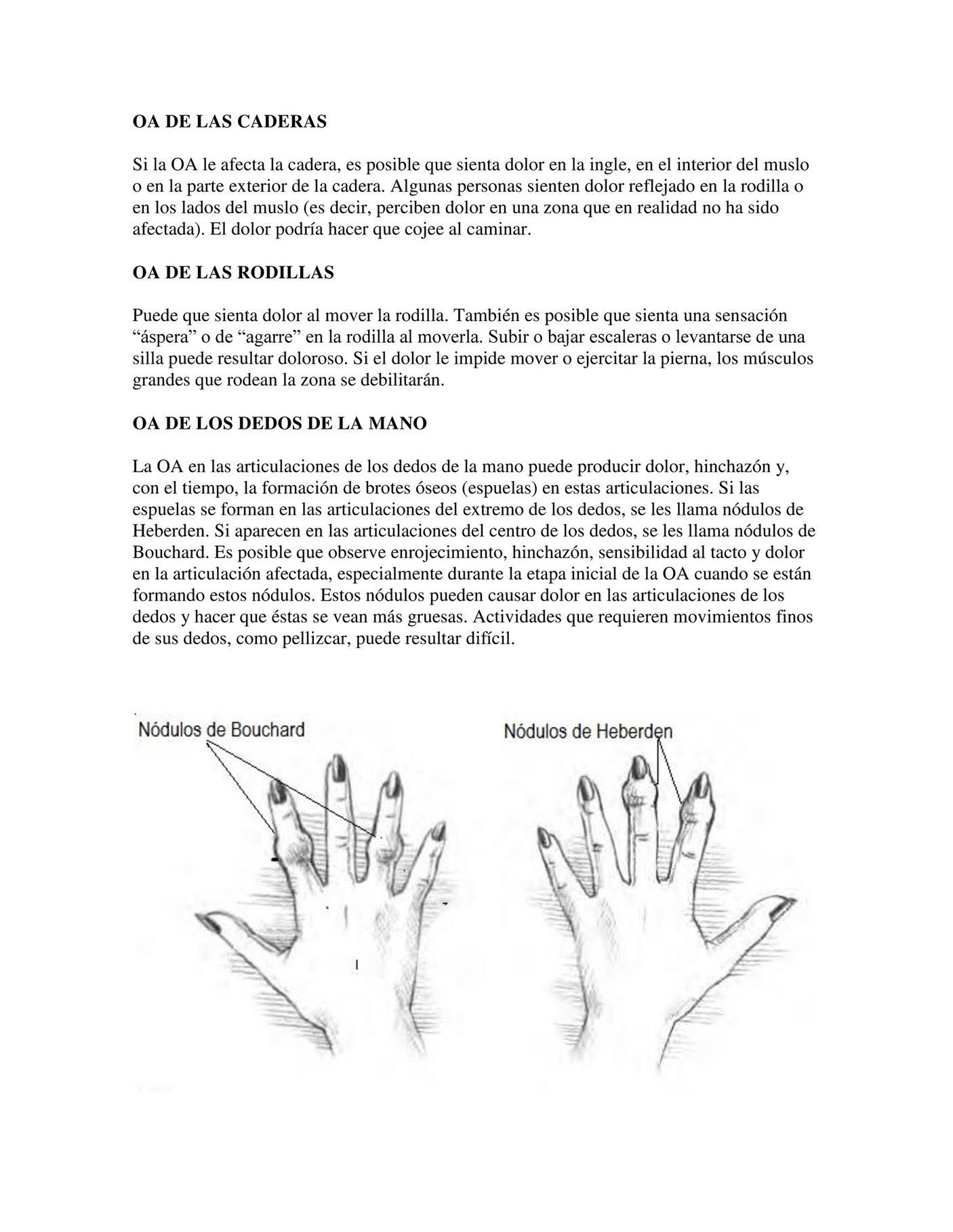 dolor en la cadera de la ingle bajando escaleras