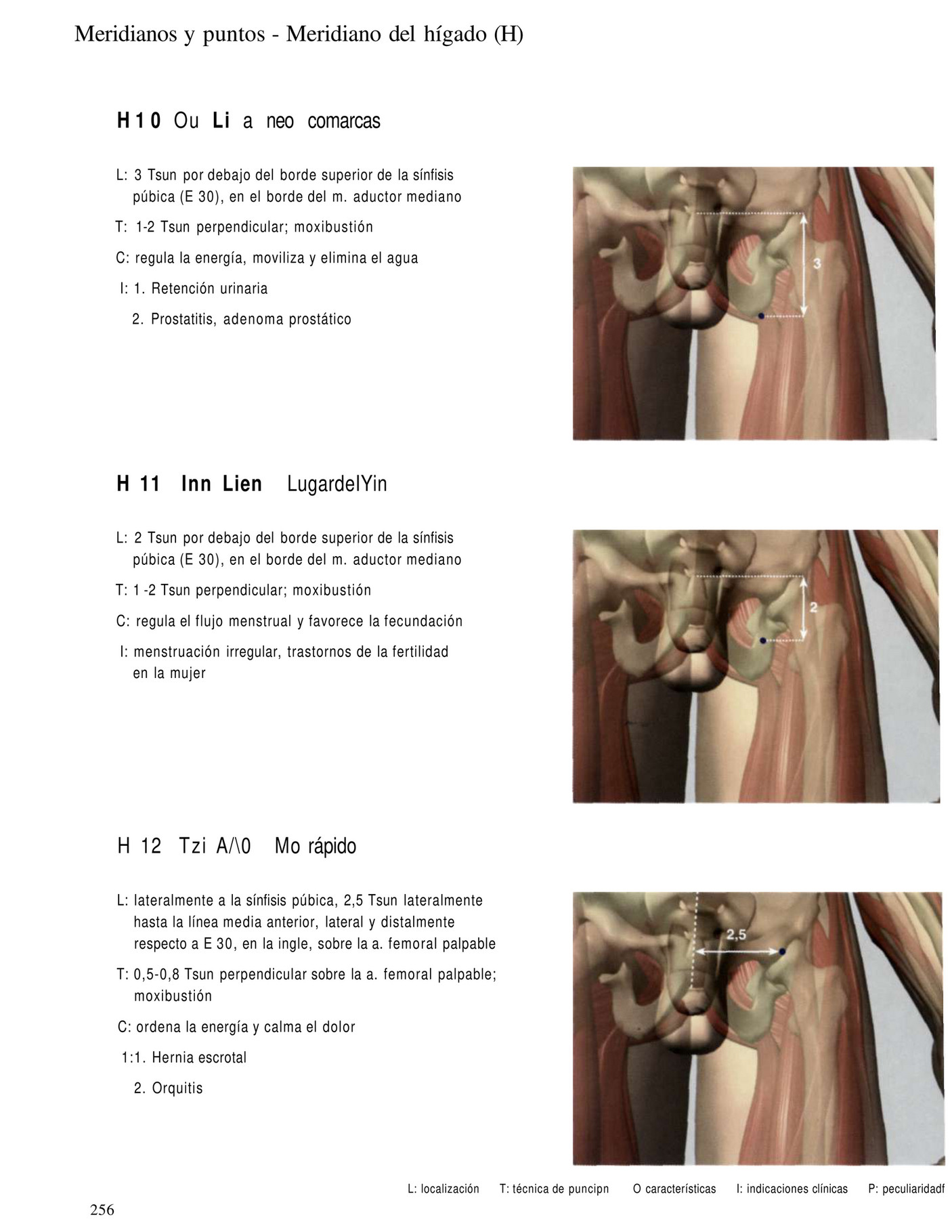 vs adenoma prostático kimmel