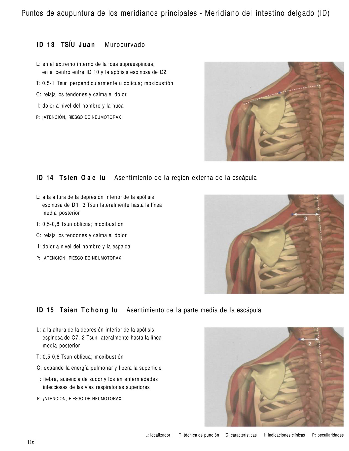 tendinitis tratamiento acupuntura