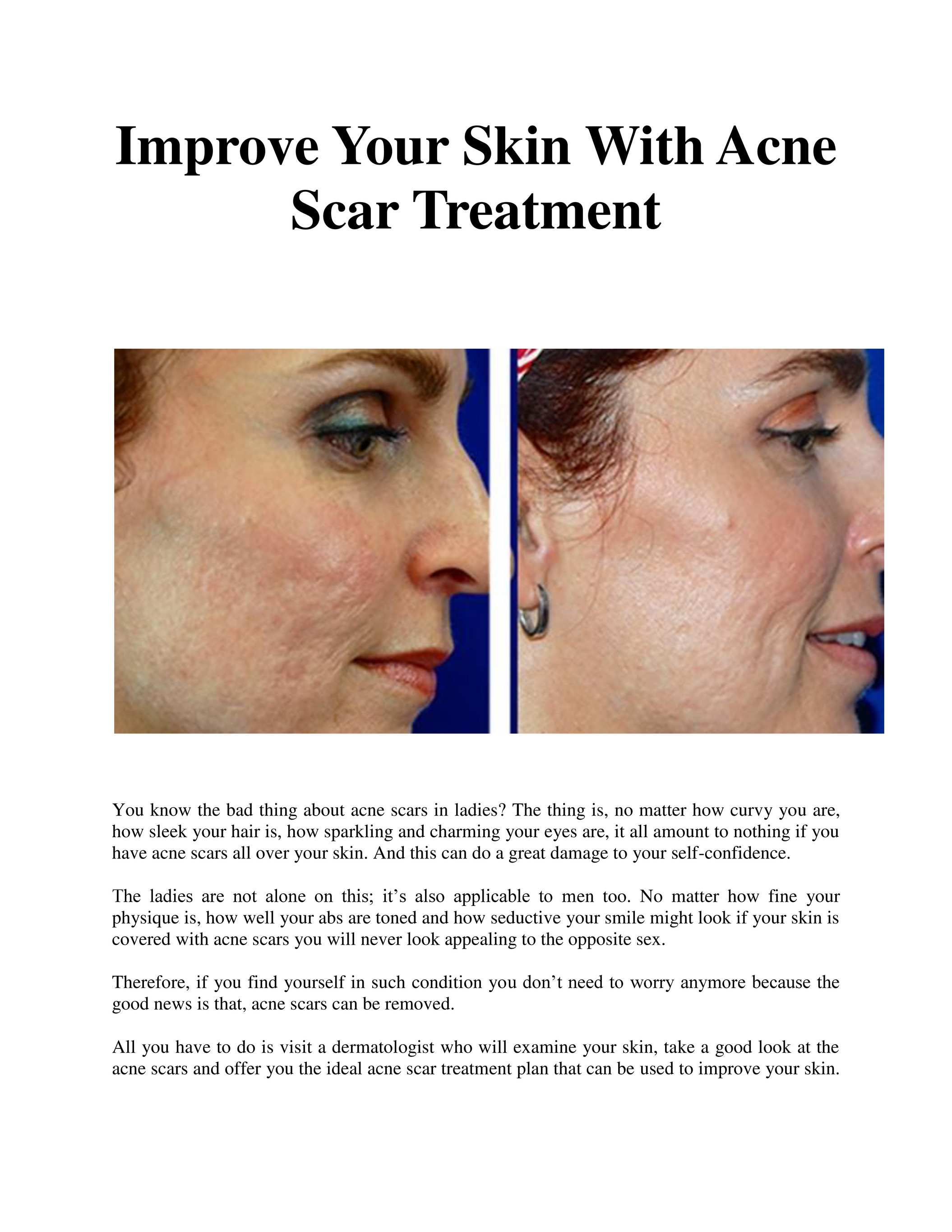 good scar treatment
