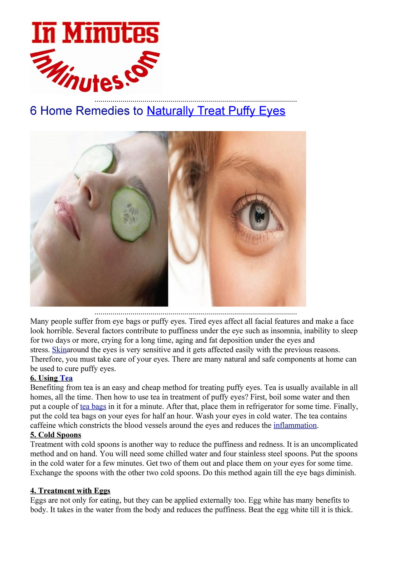 My Publications 6 Home Remedies To Naturally Treat Puffy Eyes Page My Publications 6 Home Remedies To Naturally Treat Puffy Eyes Page