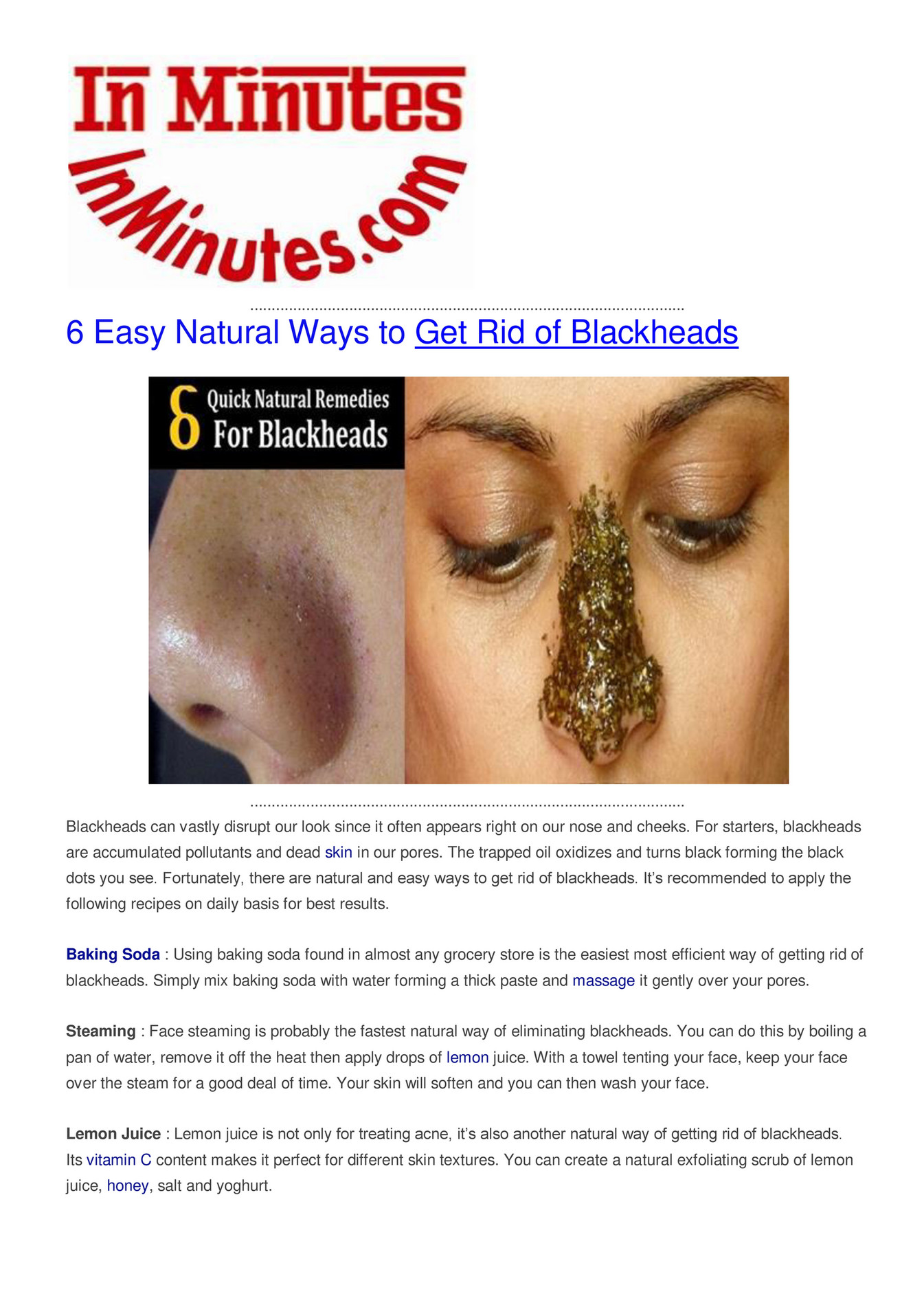 Doctor Reveals The Fastest Way To Get Rid Of Big Blackheads - zl8u30m