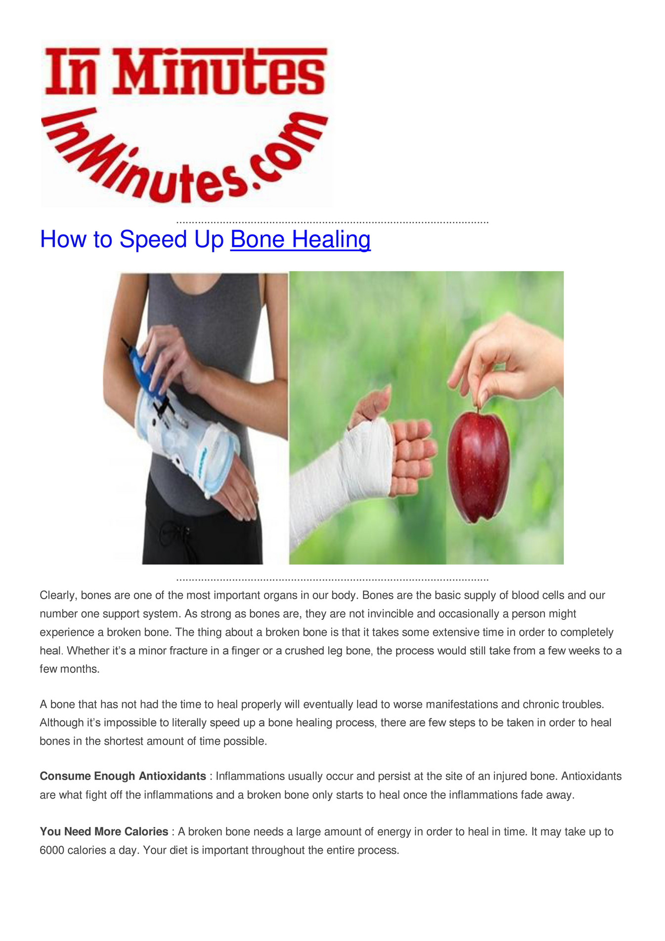 My Publications How To Speed Up Bone Healing Page 1 Created With My Publications How To Speed Up Bone Healing Page 1 Created With
