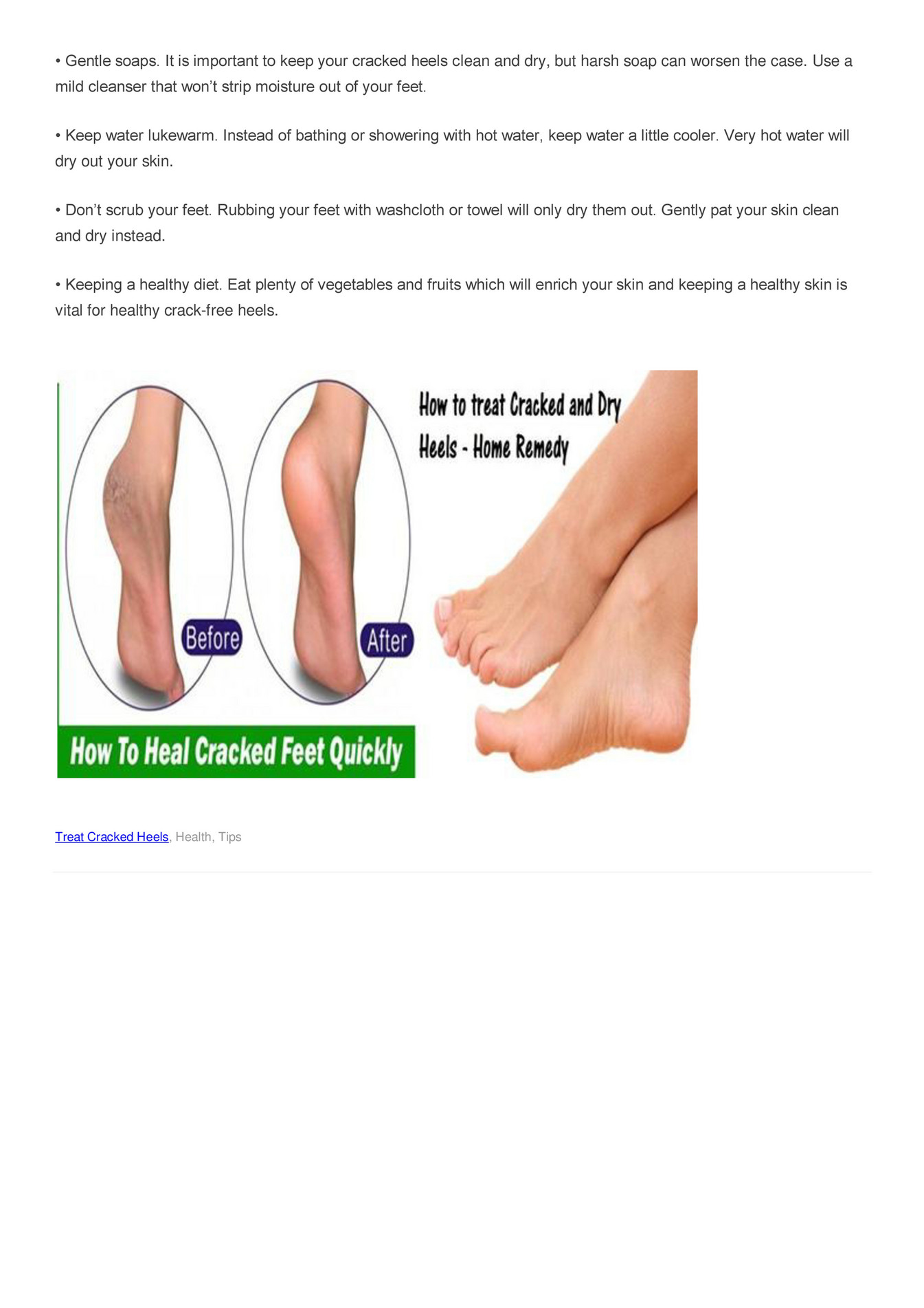 Tips for hot sale dry feet