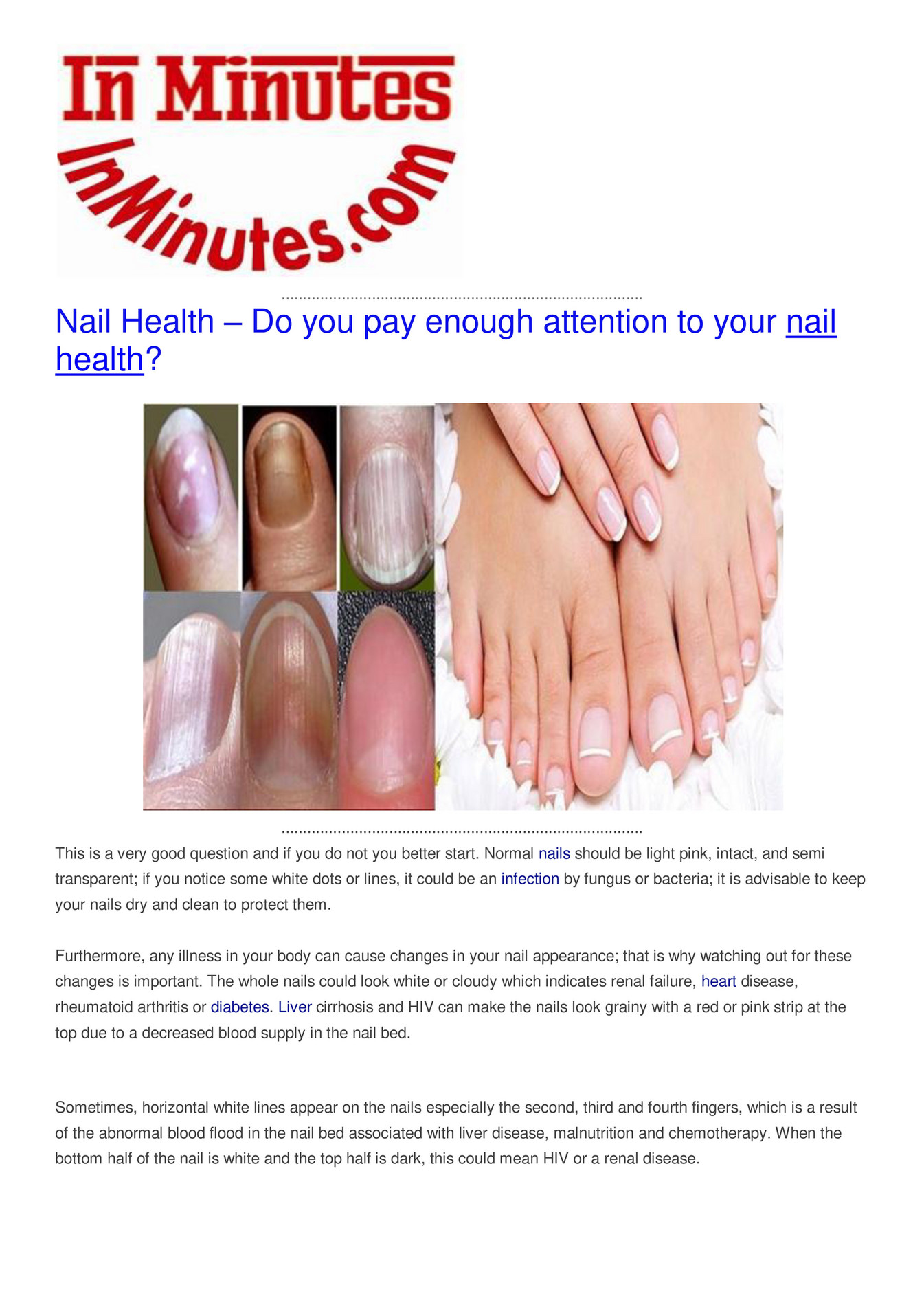 What your nails say about your health? - Elite Hospital