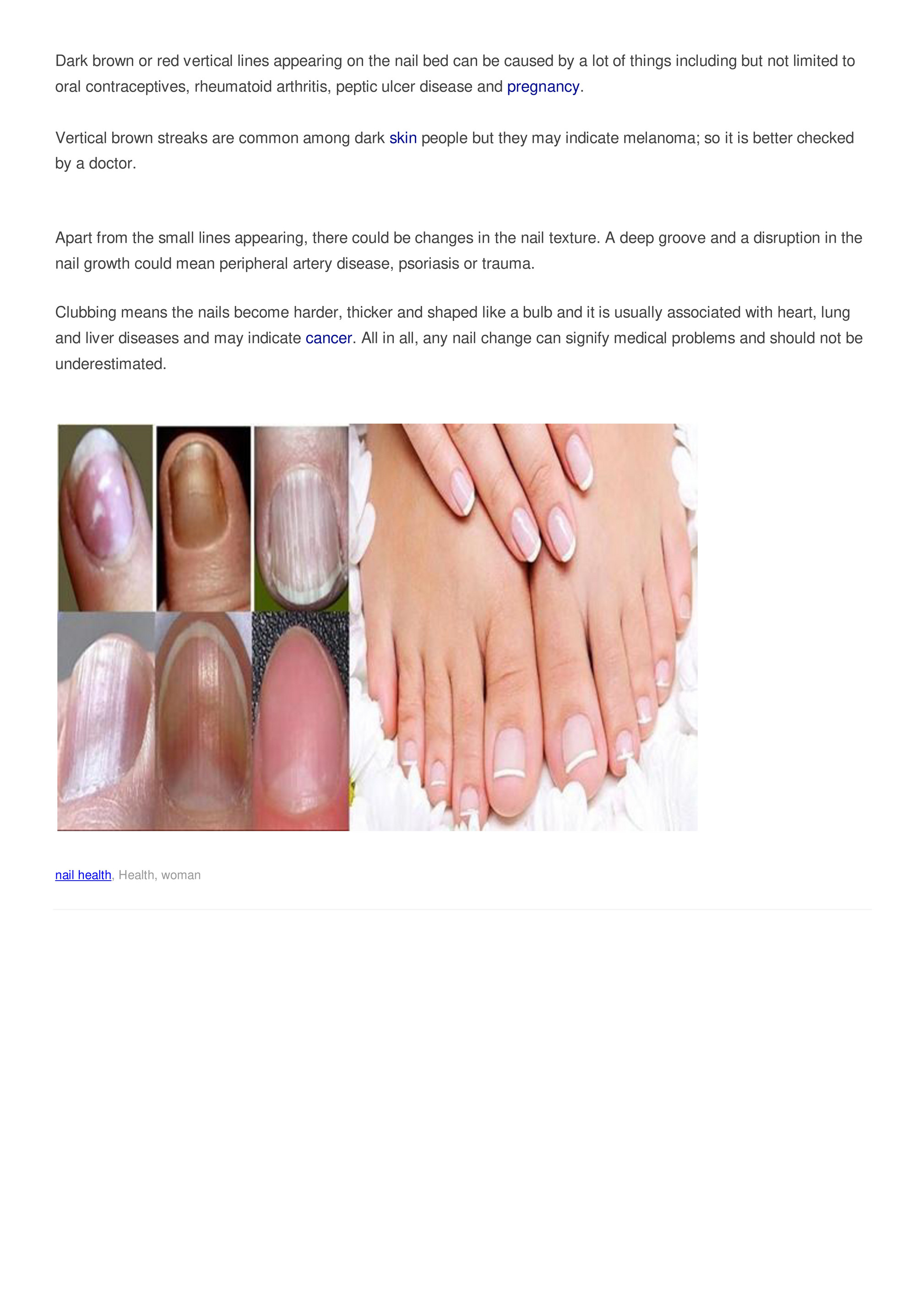 My publications - Nail Health - Page 1 - Created with 