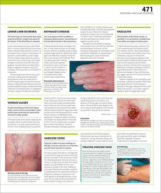 Claudication Rash Libraria Online - The Complete Human Body- The Definitive Visual Guide ...