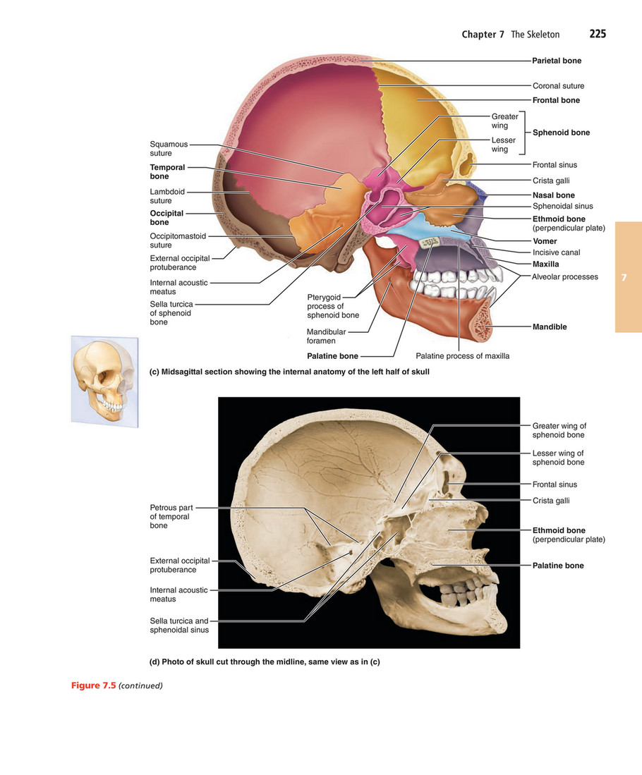 Midsagittal Section Of The Skull Human Brain Midsagit