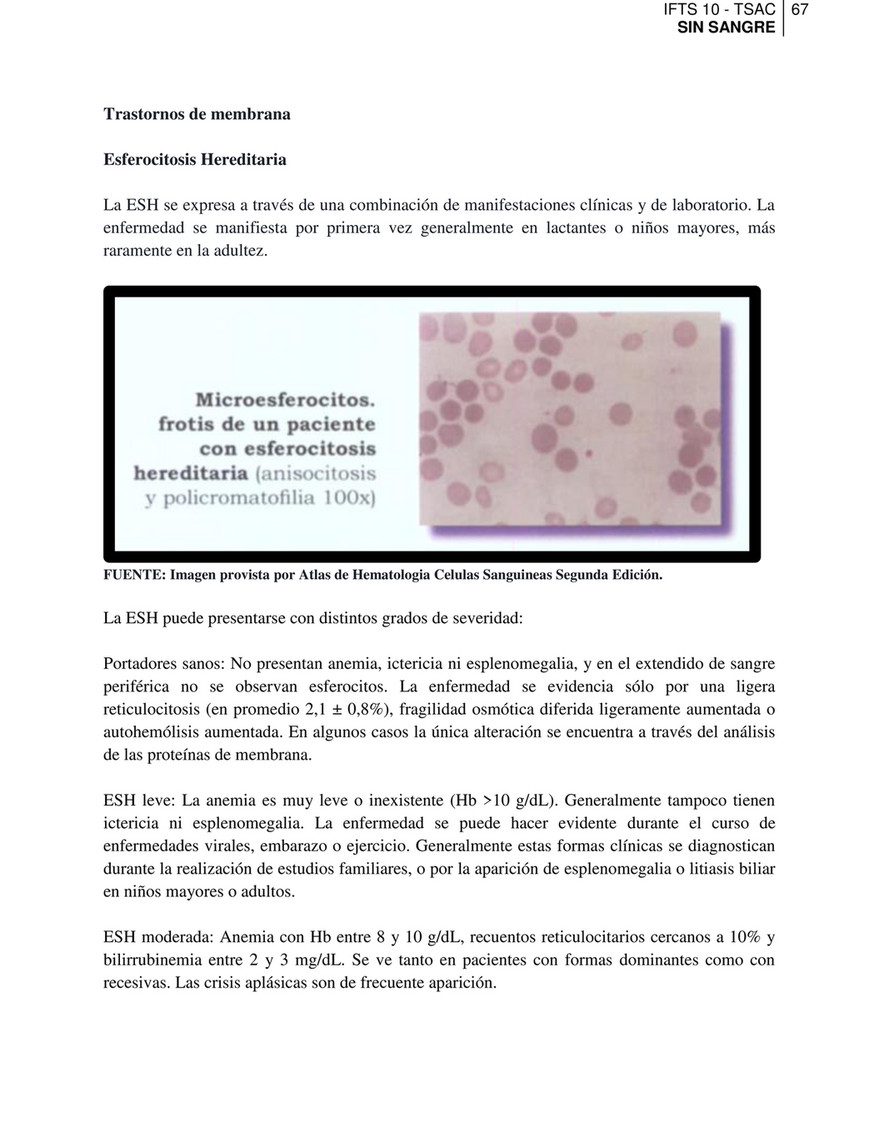 Esplenomegalia leve a moderada Esplenomegalia leve a moderada