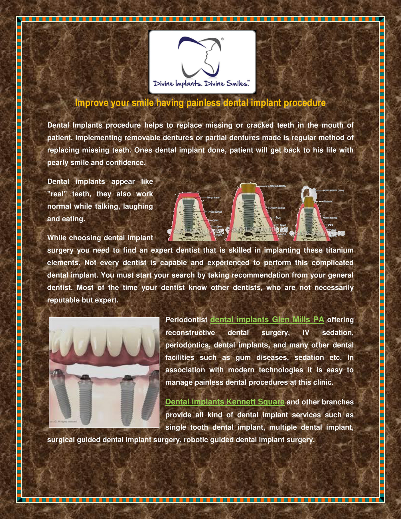 Dr Sam Khoury Dental Implant Procedure Page 1 Created With 6076