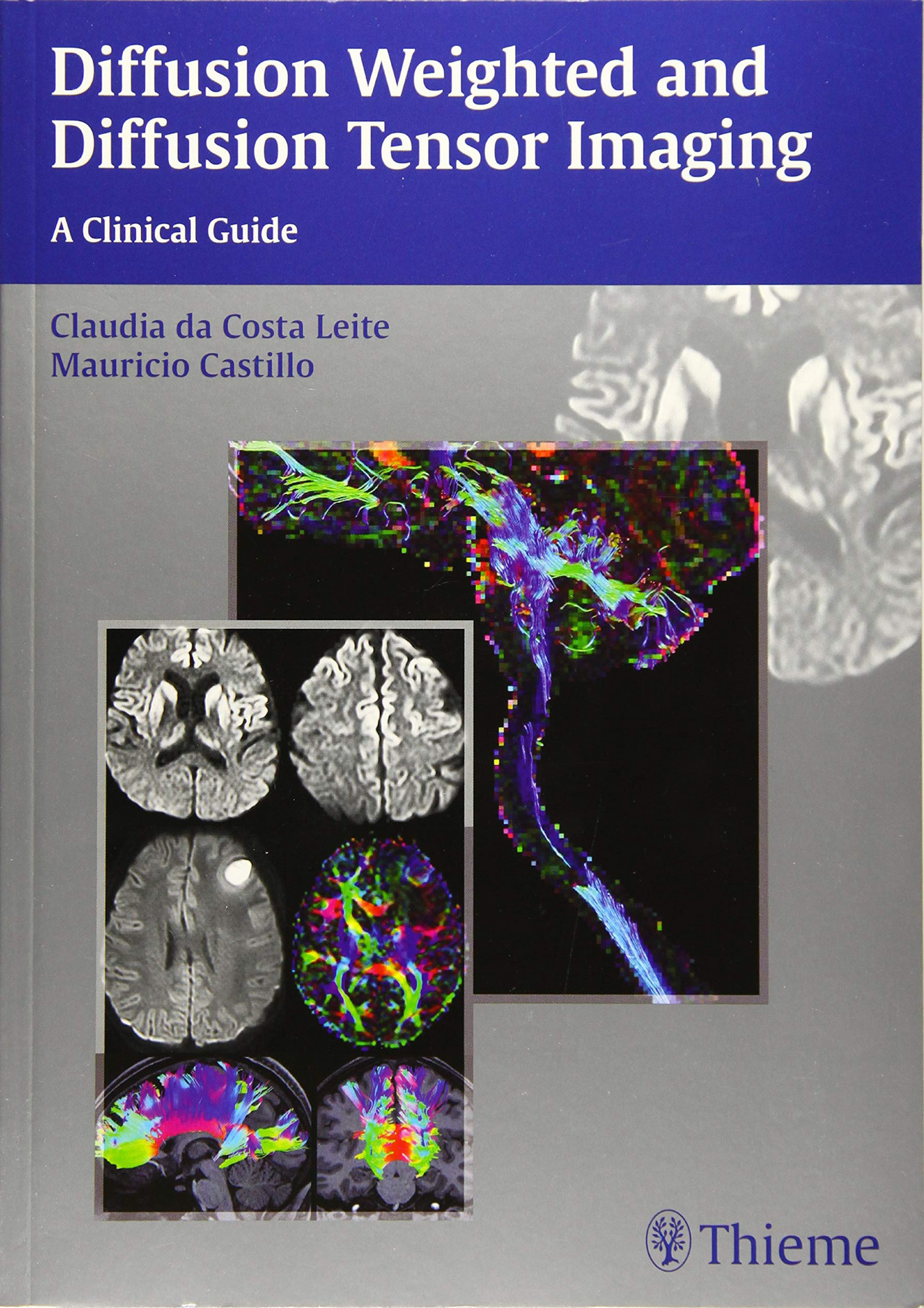 eBOOK - DOWNLOAD Diffusion Weighted and Diffusion Tensor Imaging A ...