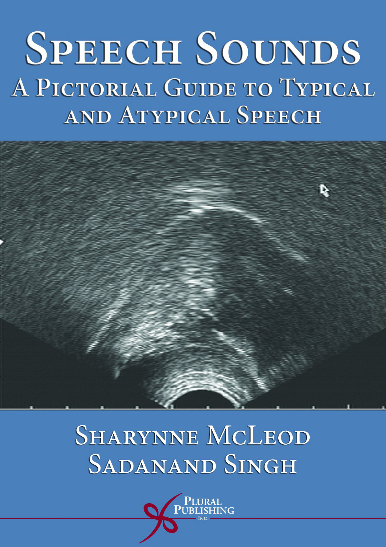 eBOOK EBOOK Speech Sounds A Pictorial Guide to Typical and Atypical