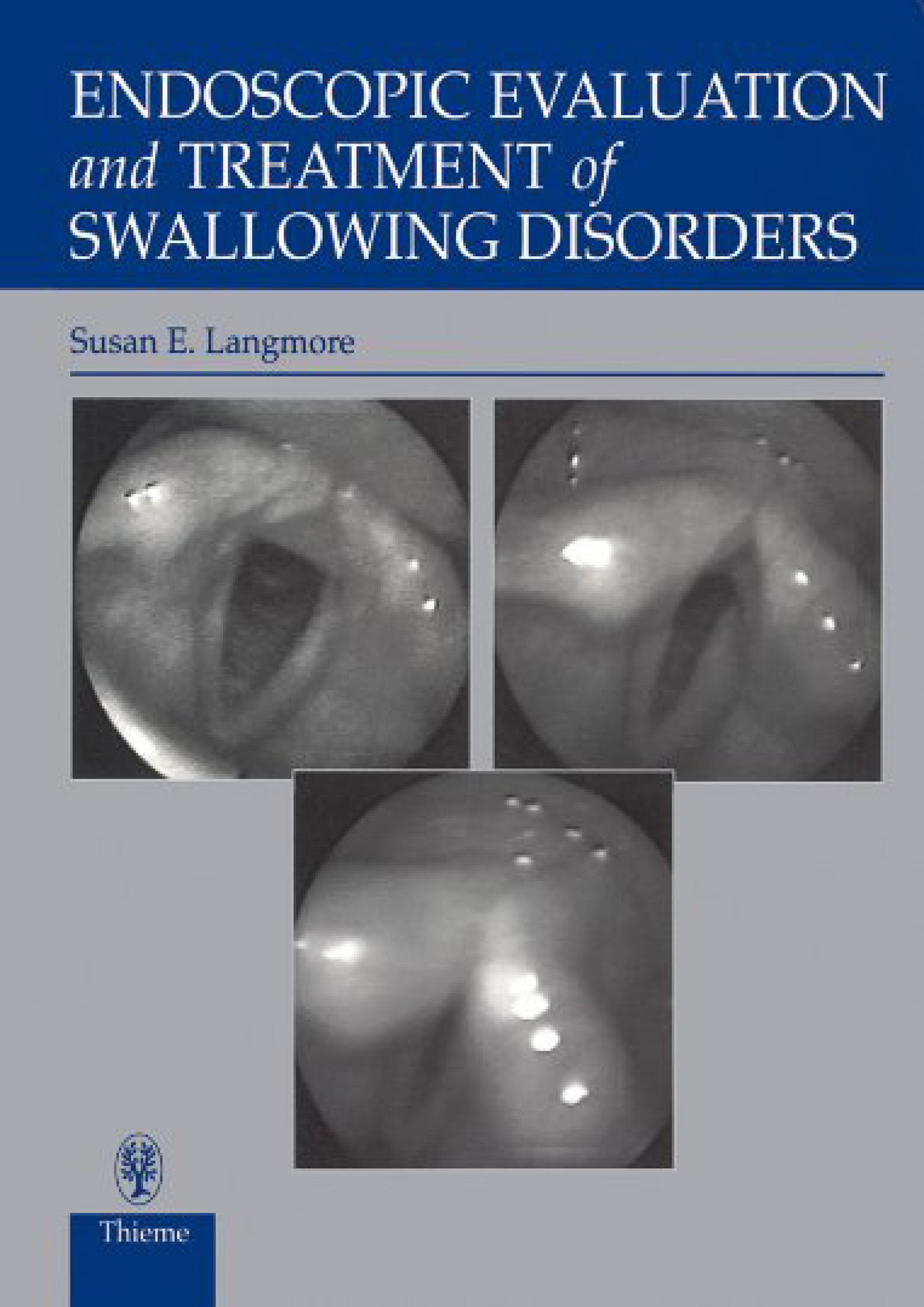 eBOOK EPUB Endoscopic Evaluation and Treatment of Swallowing