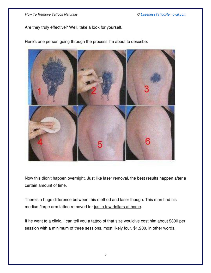 My publications - How To Remove Tattoo Naturally - Page 6-7 - Created with Publitas.com