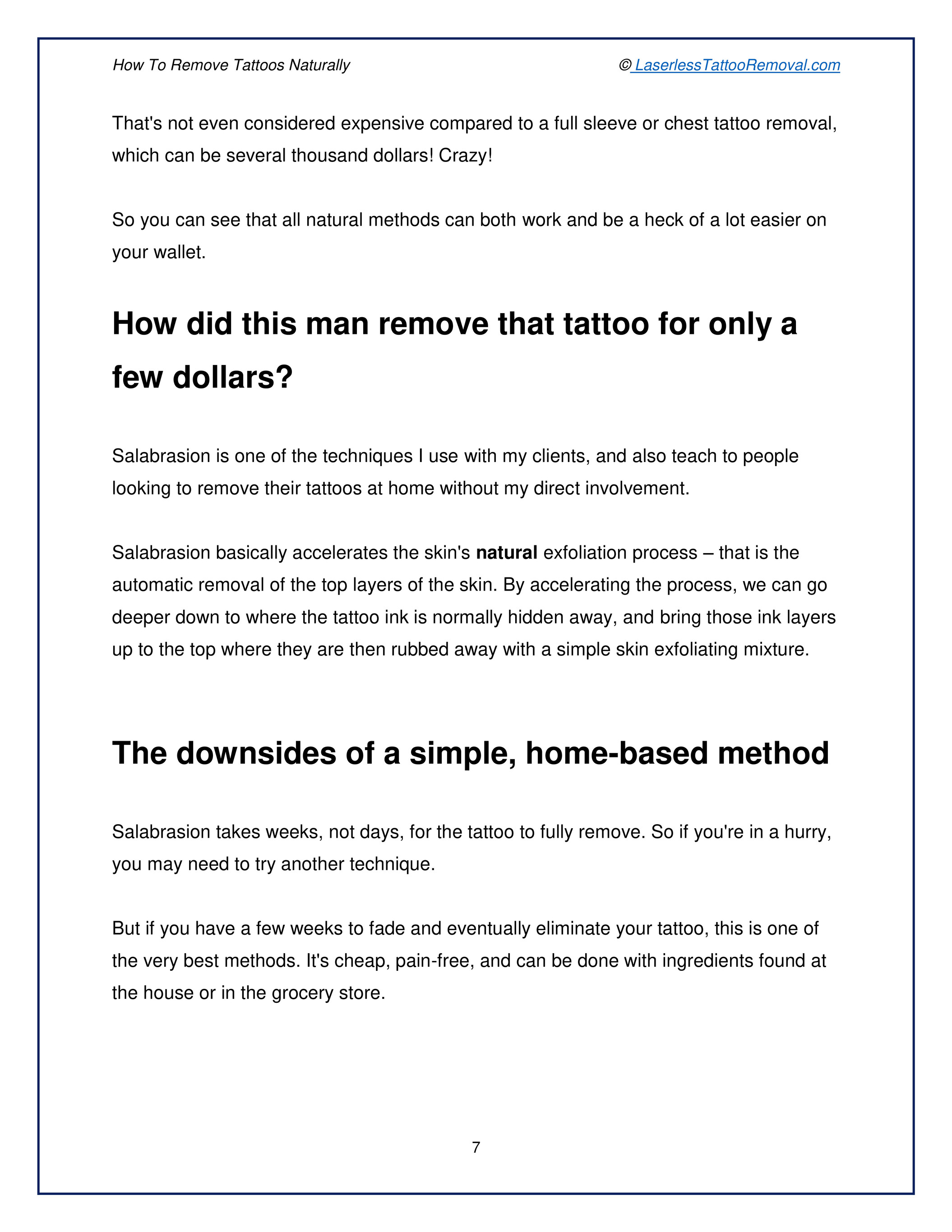 Tattoo Removal Tips, Questions and Answers - MMSCENE