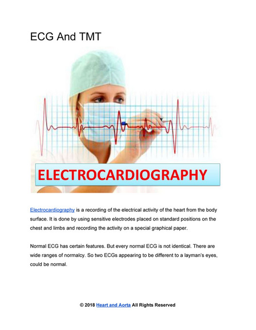 Heart and Aorta - ECG (Electrocardiography) And TMT (Treadmill Test ...