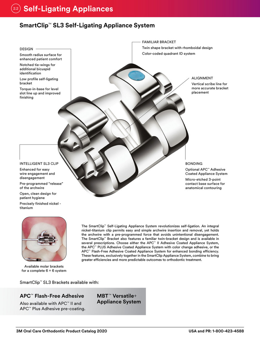 Smart Clip Self-Ligating Braces